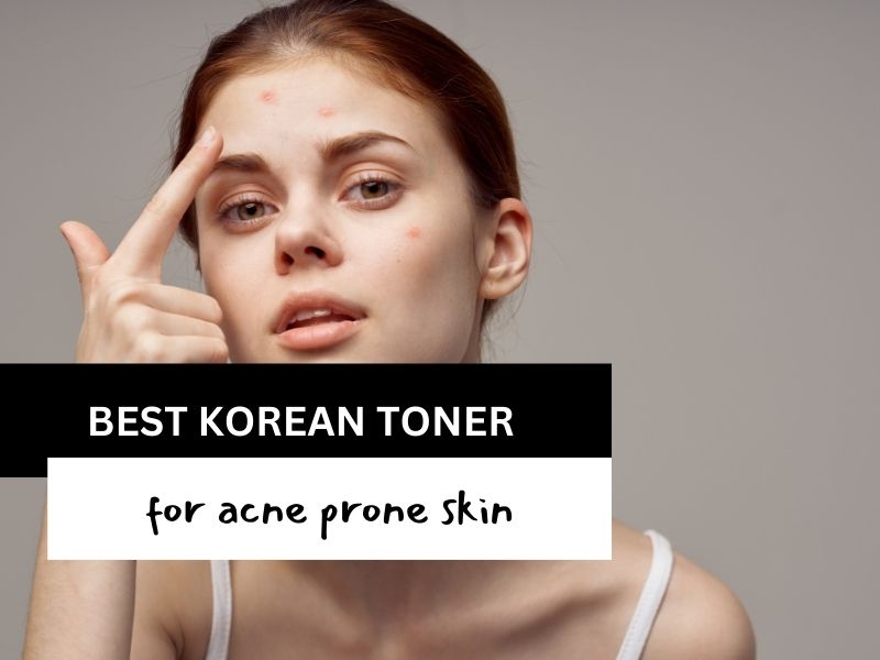 best korean toner for acne prone skin